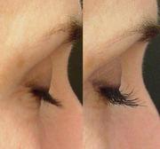 Продажа  Карепроста (Careprost,  Kareprost) в Киеве и в Украине