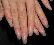 наращивание ногтей акрилом